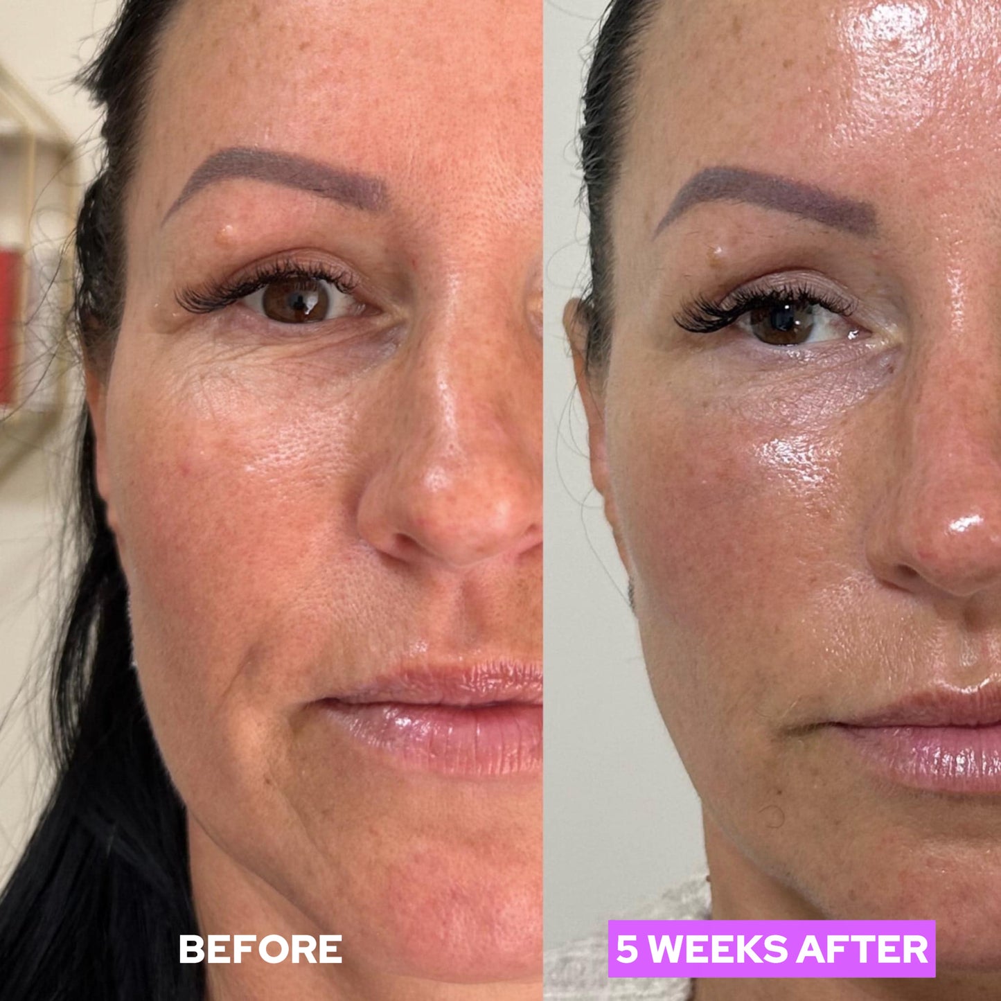Serra Collagen Blend